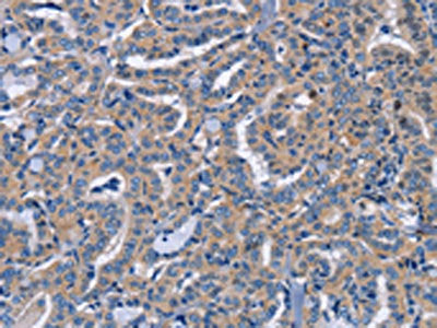 NCR2 Antibody