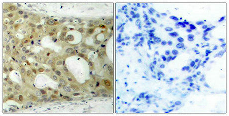 Phospho-AR (Ser650) Antibody
