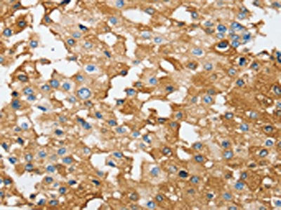 SESN2 Antibody
