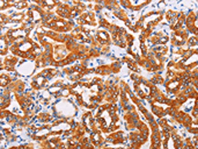SYVN1 Antibody