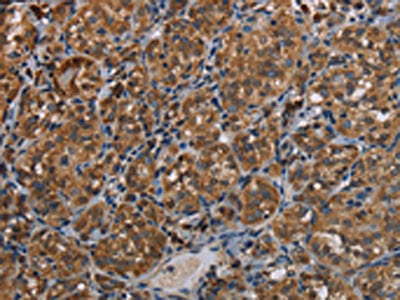 LLGL1 Antibody