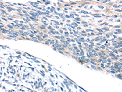 ADRB3 Antibody
