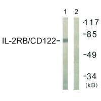 IL2RB (Ab-364) Antibody