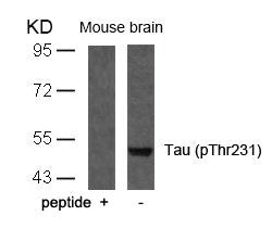 Phospho-MAPT (Thr231) Antibody