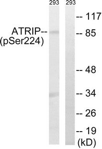 Phospho-ATRIP (Ser224) Antibody