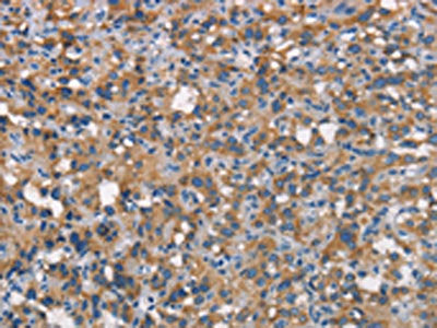 CEACAM6 Antibody
