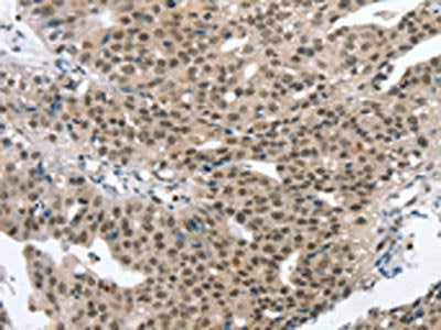 MED12 Antibody