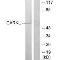 SHPK Antibody