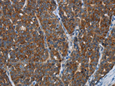 KISS1R Antibody