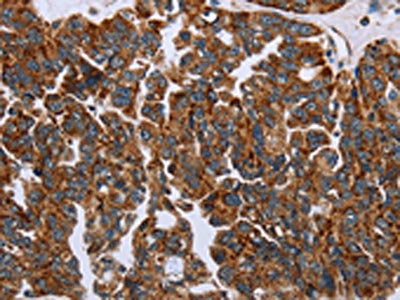 HSD3B2 Antibody