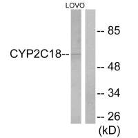CYP2C18/CYP2C8/CYP2C9/CYP2C19 Antibody