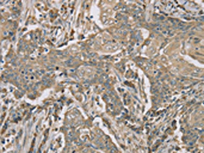 TFRC Antibody