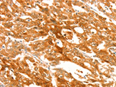 TRPM7 Antibody