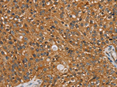 NT5C1A Antibody