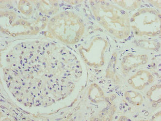 SUSD6 Antibody