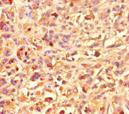 KAT2B Antibody