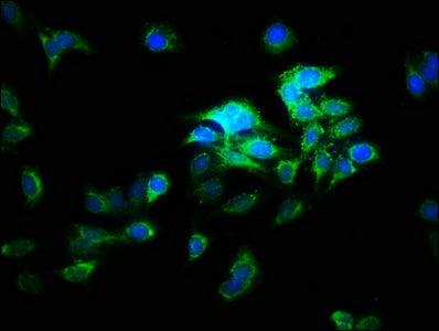 ATP6V1E2 Antibody