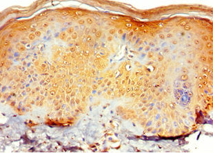 RNF125 Antibody