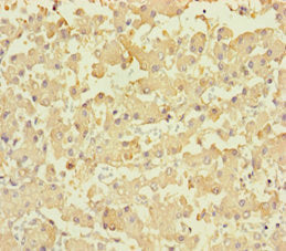 PLPPR2 Antibody
