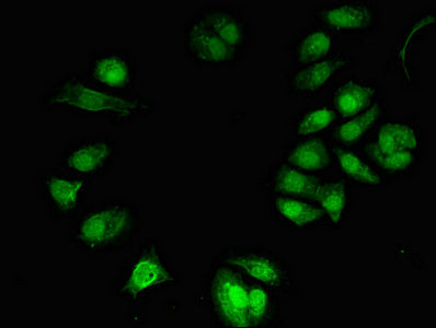 TONSL Antibody