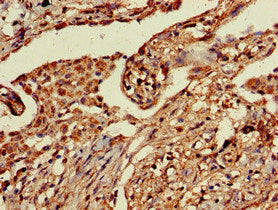 PRR11 Antibody