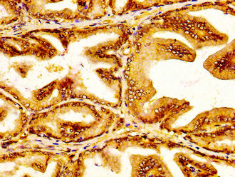 SLC45A3 Antibody