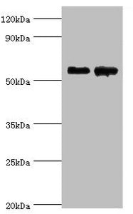 CNDP1 Antibody