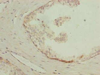 LYSMD1 Antibody