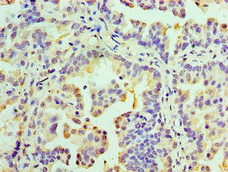 RMDN3 Antibody
