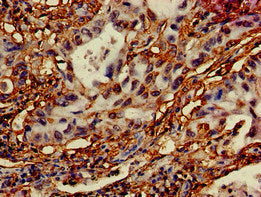 DRAM1 Antibody