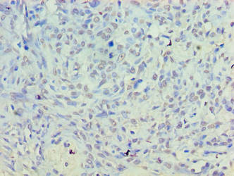 PLD5 Antibody