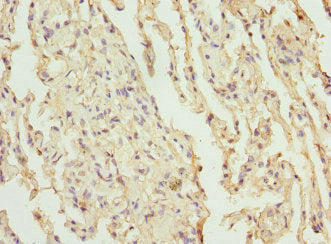 CEP120 Antibody