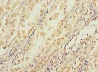 CCDC150 Antibody