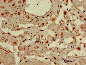 WDR19 Antibody