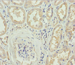 DOCK8 Antibody