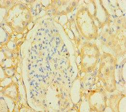 PPTC7 Antibody