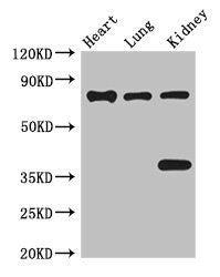 BRSK1 Antibody