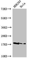 RNASEH2C Antibody