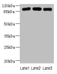 ASAP3 Antibody
