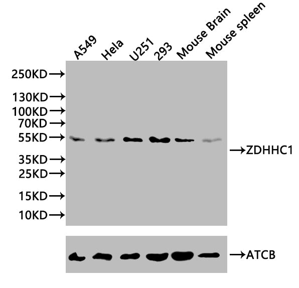 ZDHHC1 Antibody