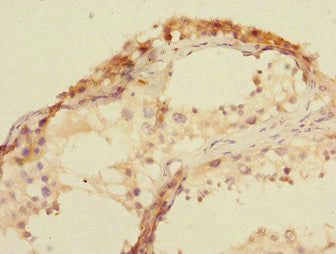 U2AF1L4 Antibody
