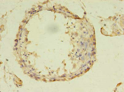 ASB13 Antibody