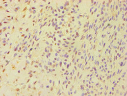 BSND Antibody