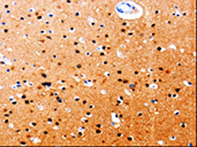 GDI1 Antibody