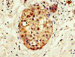 CREBBP Antibody