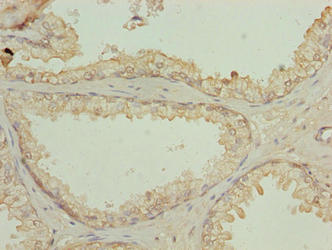 N4BP2L2 Antibody