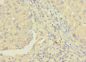 RAB8B Antibody