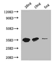 MTB Antibody