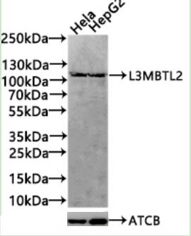 L3MBTL2 Antibody