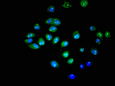 UBE2E3 Antibody